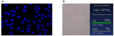 Effect of BLV Infection on the Immune Function of Polymorphonuclear Neutrophil in Dairy Cows